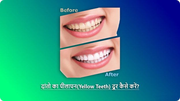 teeth yellow