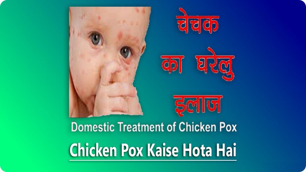 chicken pox final pic