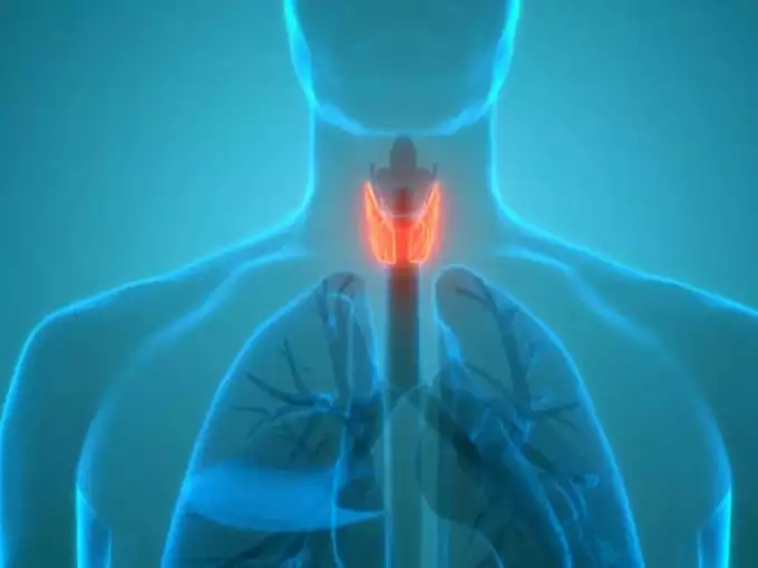 thyroid pic 1